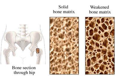 bone tissue contains large