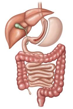 Duodenal stump - Small bowel-small bowel