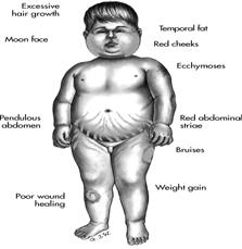 Cushingoid Appearance Cushing Syndrome Therapeutic management Surgery Replacement of growth hormone, ADH, TH, gonadotropins, and steroids Nursing considerations Congenital Adrenal Hyperplasia (CAH)