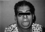 Acromegaly Diagnostic Evaluation History