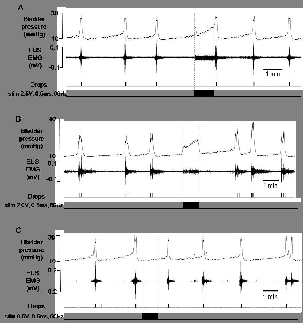 Figure 4.3. Electrical stimulation of the midbrain suppressed cyclical voiding responses evoked by continuous infusion of saline (6 ml h -1 ) into the bladder.
