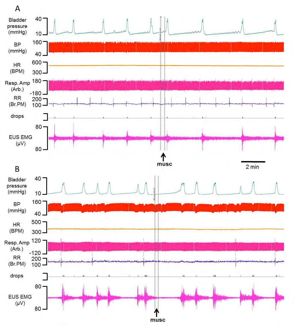 Figure 3.5. Microinjection of muscimol (250 pmol in 50 nl) evoked no changes in the cardiovascular and respiratory parameters recorded at both inhibitory (A) and no effect (B) sites.