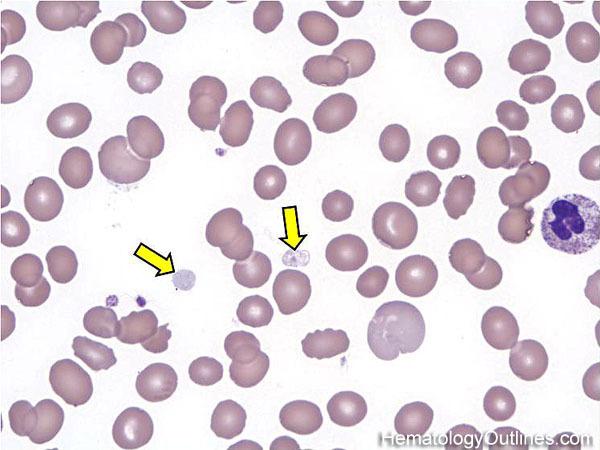 red blood cells white blood cells platelets leukocytes Question Prompt: 5 The white blood