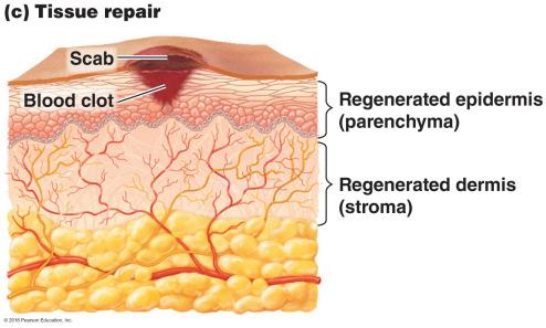 Inflammation Tissue repair Endotoxins and the pyrogenic response Repair is not complete until all harmful substances