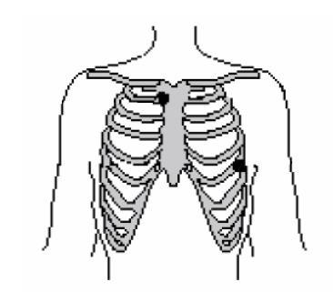 20 just below the collar bone while the other one should be attached to the left side of the body below the heart (on the rib cage).