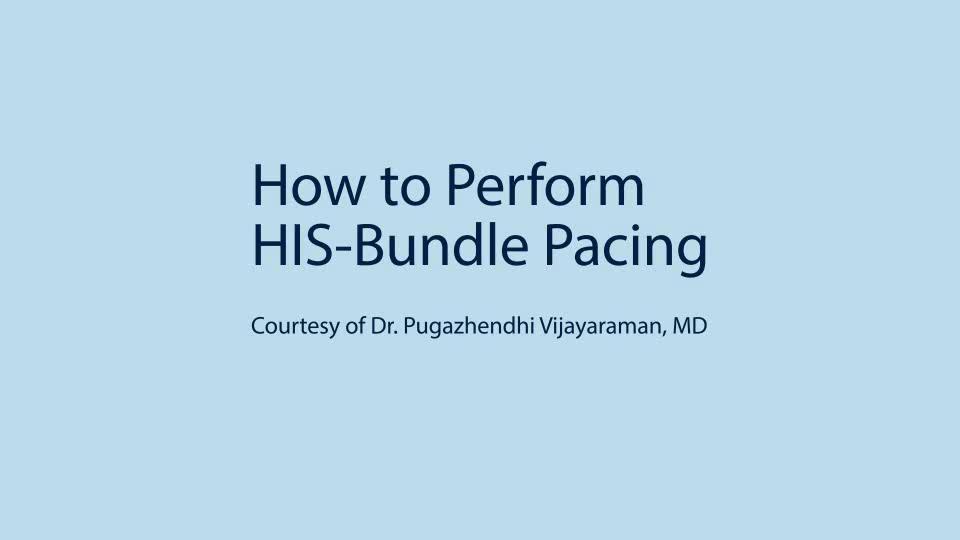 OVERVIEW OF HIS-BUNDLE PACING ANATOMY OF HIS-BUNDLE PACING Disclaimer: This presentation is provided for general educational purposes only and should not be considered the exclusive source for this