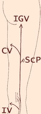 thigh) ScP Sciatic Perforator IV