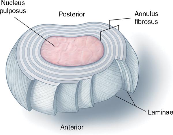 Figure 1.3. Diagram of intervertebral disk showing the outer annulus fibrosus and the inner nucleus pulposus. The annulus fibrosus has multiple layers or laminae.