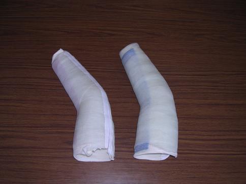 worn for long periods to accommodate elongation of soft tissue.