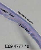 4779 Gingilacer mouthwash Cellular viability Contact time: 10 minutes % Cellular viability (average) Standard deviation (%) 105 8.7 91 9.9 82 9.6 110 29.9 Positive control - SDS 5% 64 6.