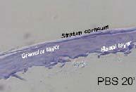 18 C to 24 C), after which the epithelia are rinsed with 25 ml phosphate buffer saline (PBS).