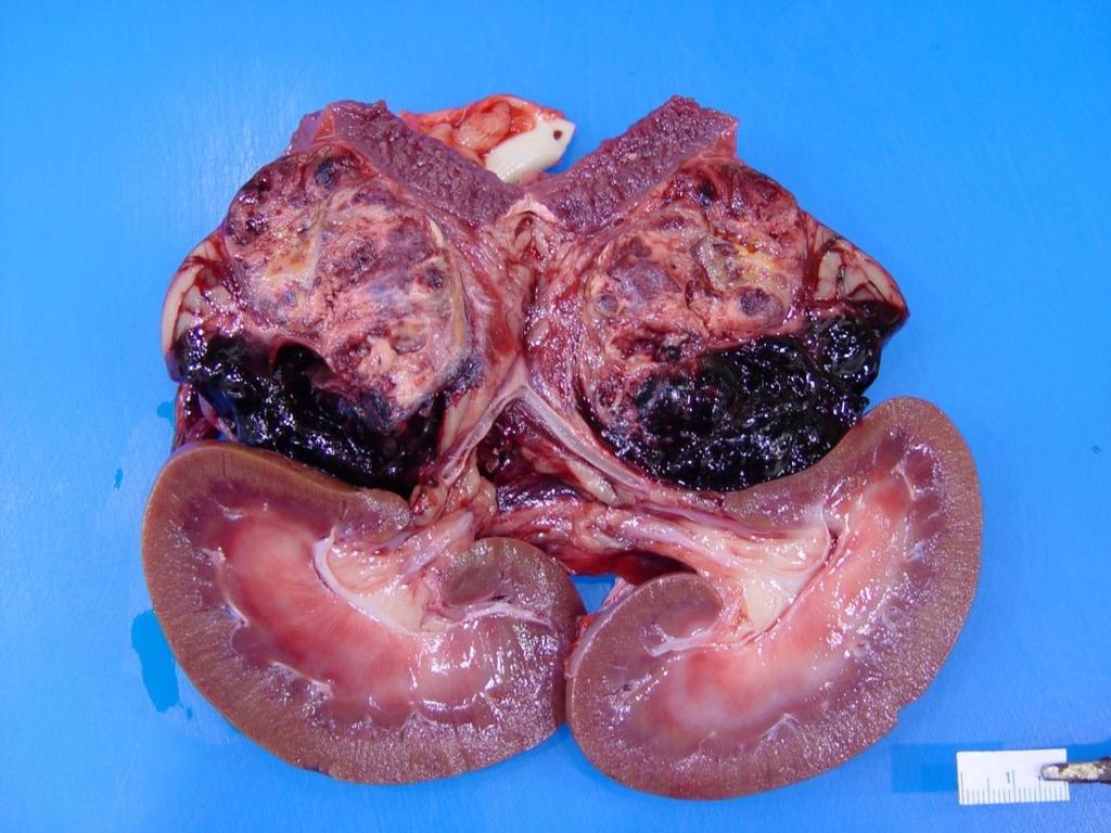 Case 2: 7 year old, male castrated Staffordshire Terrier Description: (Extensive retroperitoneal hemorrhage that partially covers both adrenal glands and part of
