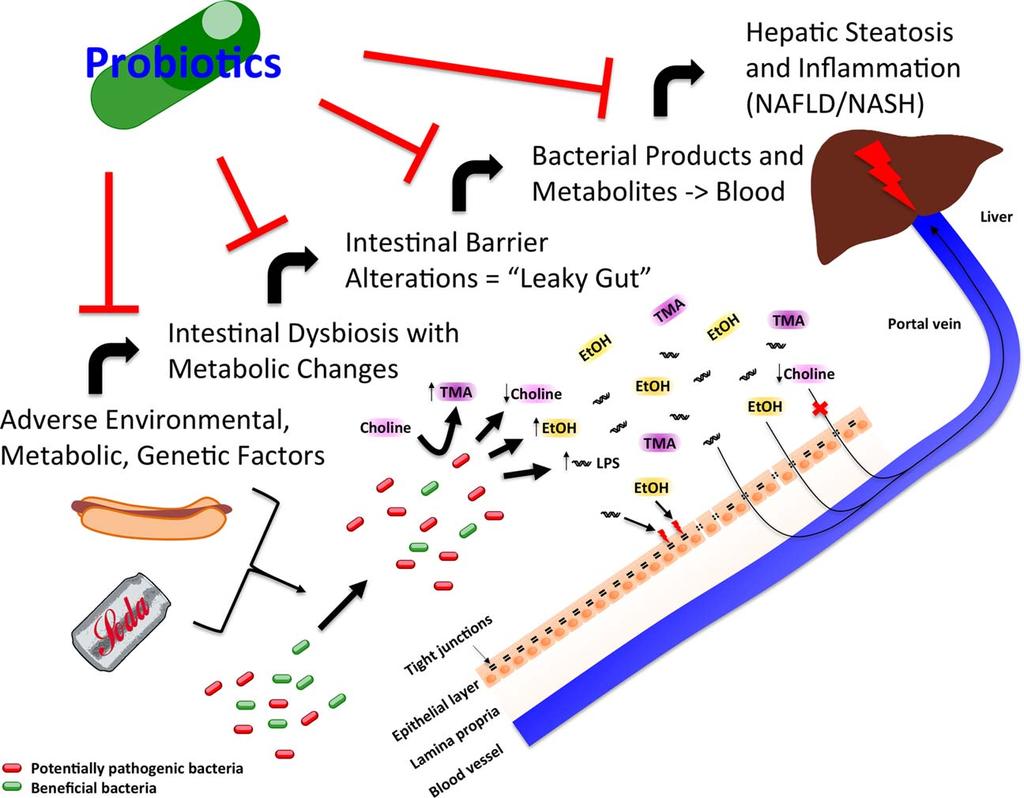 FIG 2 Simplified model of intestinal Stages in the development of nonalcoholic fatty liver disease (NAFLD) and ways probiotics can intervene.