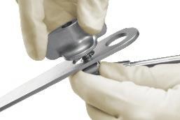 Knob, have an assistant attach all of the retractor handles to your preferred blades before