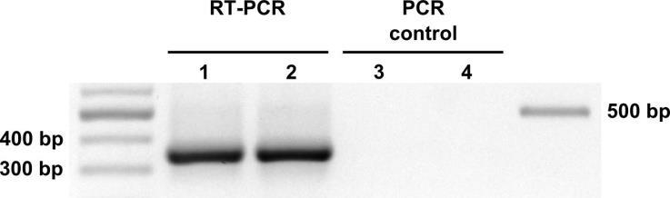 PCR amplification of β-actin transcript (353 bp fragment shown) following RNA isolation from human epithelial cells (HCT 116) with the Quick-RNA