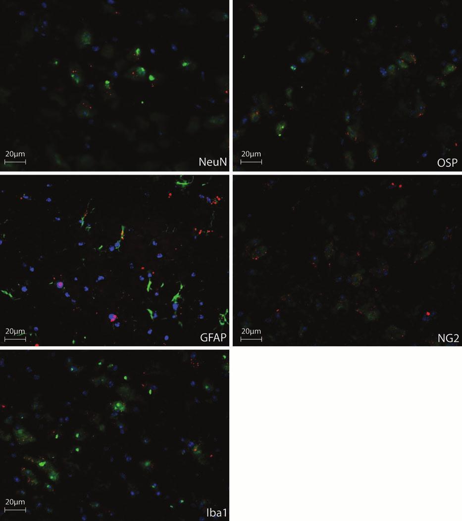 7 Supplementary Figure 7. Distribution of Cy3-GAPDH sirna in the brain. C57BL/6 mice were intravenously injected with 150µg of Cy3-labeled-GAPDH sirna (red) encapsulated in 150µg of RVG-exosomes.