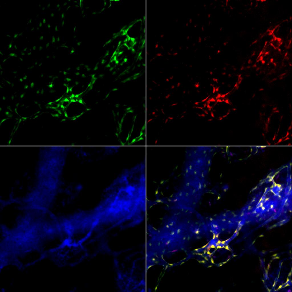 Intra-vital confocal calvarial imaging was performed on Flk1-Gfp reporter mice.