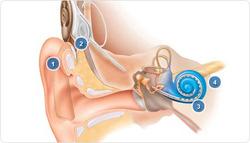 Cochlear Implant FM Systems Audiological