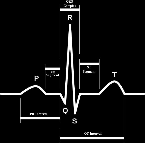 Research Article Impact Factor:.75 ISSN: 319-57X Sharma P,, 14; Volume (11): 34-55 A typical ECG tracing of the cardiac cycle consists of a P wave, a QRS wave, a T wave, and a U wave.
