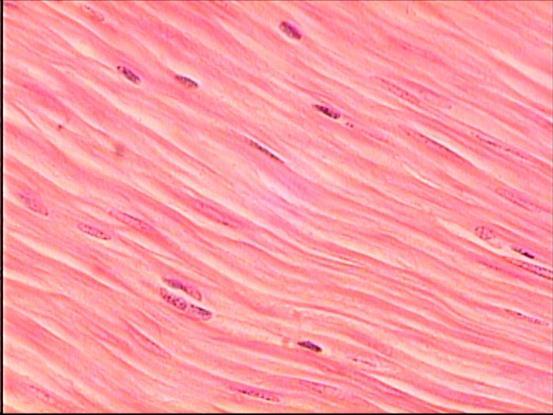 2. Smooth Muscle a. Walls of hollow organs. b. Move food & wastes. c.