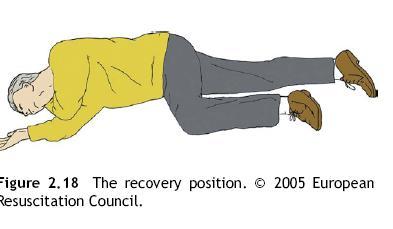If the victim has to be kept in the recovery position for more than 30 min turn