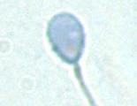 Xenobiotics may induce sperm