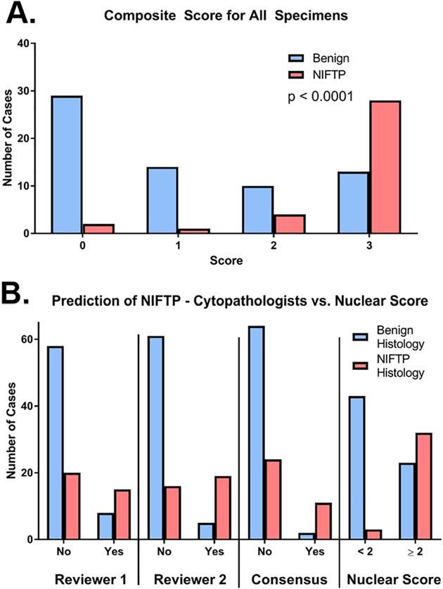Figure 3. The composite nuclear score is a more sensitive indicator of noninvasive follicular thyroid neoplasm with papillary-like nuclear features (NIFTP) than the impression of cytopathologists.