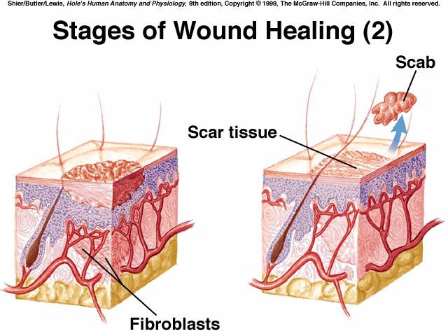 accessory organs of the skin autograft transferring unburned skin to burned area, homograft cadaveric skin from a skin bank (cadaver), skin substitutes amniotic membrane from