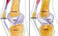 attaching the medial condyles of femur and tibia It protects the joint