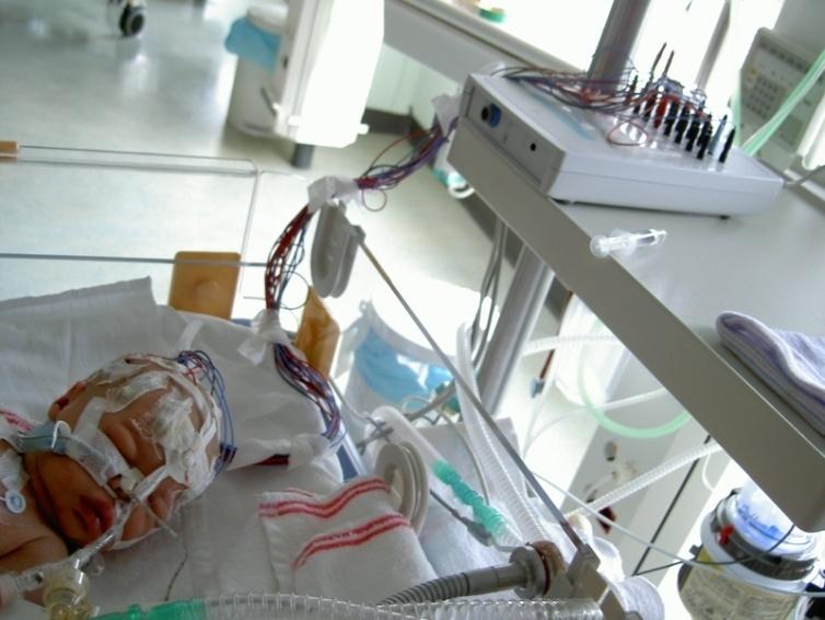 Neonatal brain monitoring à seizure detection Lack of oxygen supply