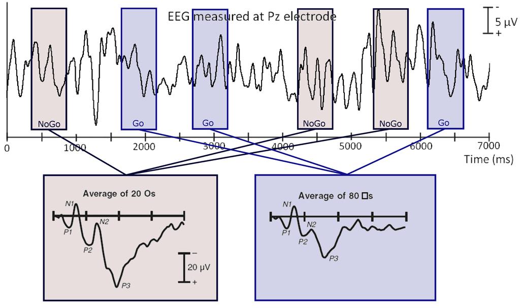32 EEG analysis