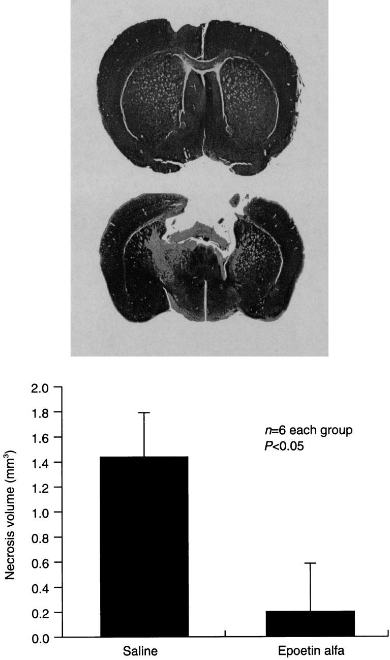 10 A. Cerami et al. Fig. 2. Volume of cortical impact injury with systemic epoetin alfa treatment. Mice were given saline or epoetin alfa, 5000 IUukg i.p., 24 h before blunt cortical impact from a calibrated piston.