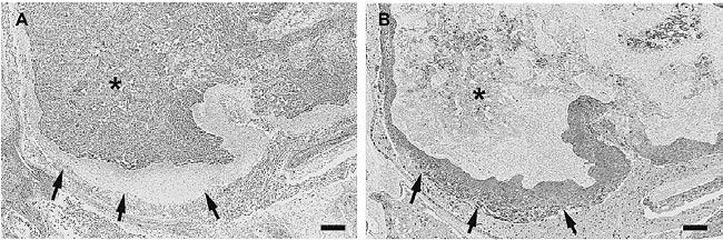 atypical mitoses. Scale bars indicate 100 μm in A and C, or 50 μm in B. Fig. 3. Micrographs in immunohistochemical examinations. (A) vimentin and (B) cytokeratin.