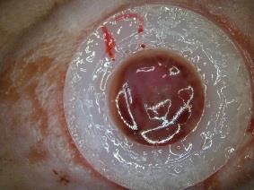 wound images of