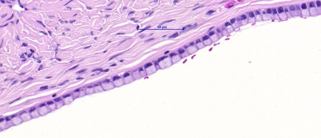 Ovarial stroma Columnar, mucin