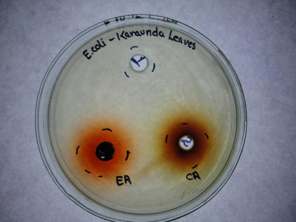 E.coli S. aureus P.