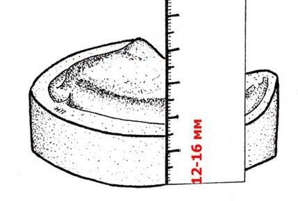 In lower impression boxing in is made in vestibular and lingual surfaces 2-3 mm below the impression border (Fig. 6.