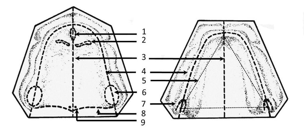 membrane that overlies a bony tuberosity. Their marking on gypsum models helps to dental technician to determine the distal denture border. Alveolar line.