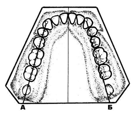 In addition for postereior lower teeth setting up a Pound s line is used (E.Pound, 1957).