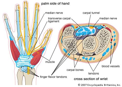 ACUTE TRAUMATIC CARPAL TUNNEL SYNDROME Athlete complains of: Volar wrist pain with passive ROM of wrist