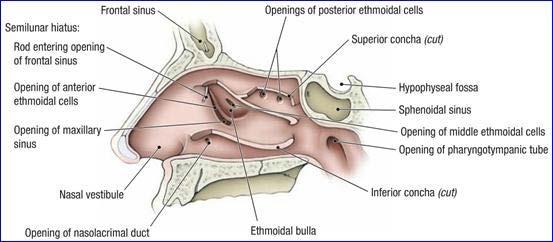 ethmoidal) hiatus / ethmoidal infundibulum: anterior ethmoidal cells and