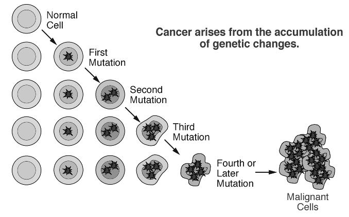 Prostate Cancer Oncogenesis 1. Primarily a stochastic process 2. Progressive accumulation of heritable genetic events 3.