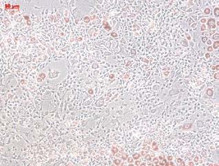 Adipocyte differentiation medium added A 3T3-L1 rtta Vpr
