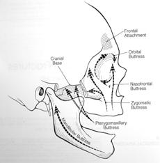 Nasal Septum Horizontal Beams 1. Frontal Bar 2. Inferior Orbital Rims 3.