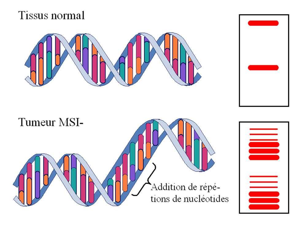 Microsatellite instability Normal DNA MSI tumour Loss or gain of