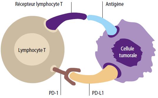 MSI CRC : immunogenic tumour Immunotherapy Check-points immunity