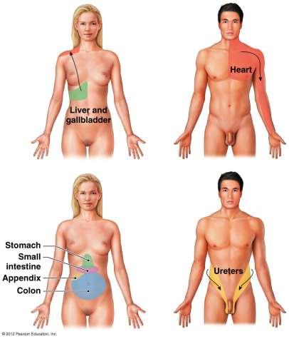 The General Senses Nociceptors Referred pain: perceived sensation from visceral organs as if from other locations Ex.