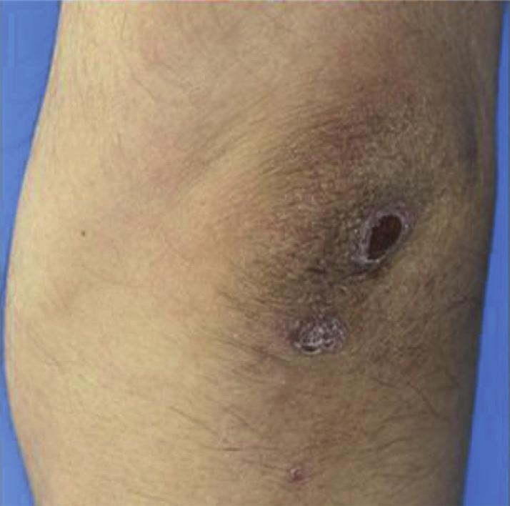 Case Presentation A 48-year-old man with a 1-month