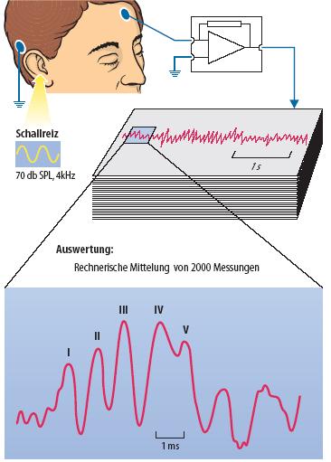 Thus, EEG brain topography was