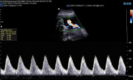 Reducing signal noise, S-Harmonic provides more uniform ultrasound images.
